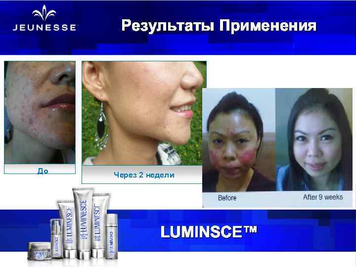 Результаты Применения До Через 2 недели LUMINSCE™ 