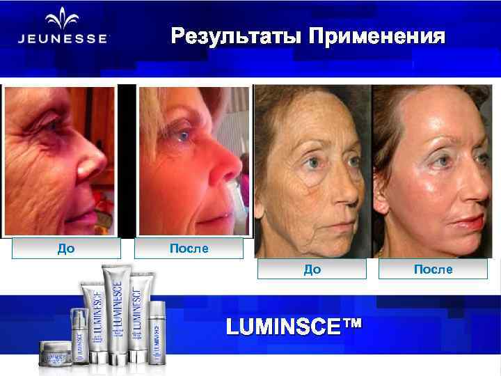 Результаты Применения До После До LUMINSCE™ После 