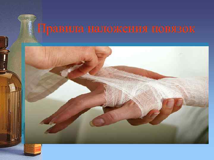 Правила наложения повязок 