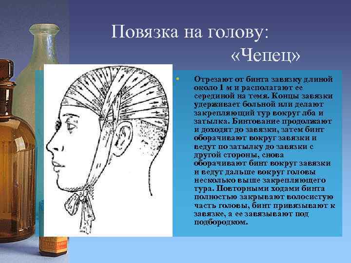 Повязка на голову: «Чепец» • Отрезают от бинта завязку длиной около 1 м и