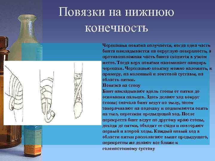 Повязки на нижнюю конечность Черепашья повязка получается, когда одна часть бинта накладывается на округлую