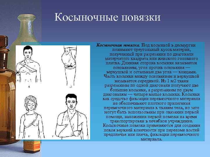 Косыночные повязки Косыночная повязка. Под косынкой в десмургии понимают треугольный кусок материи, полученный при