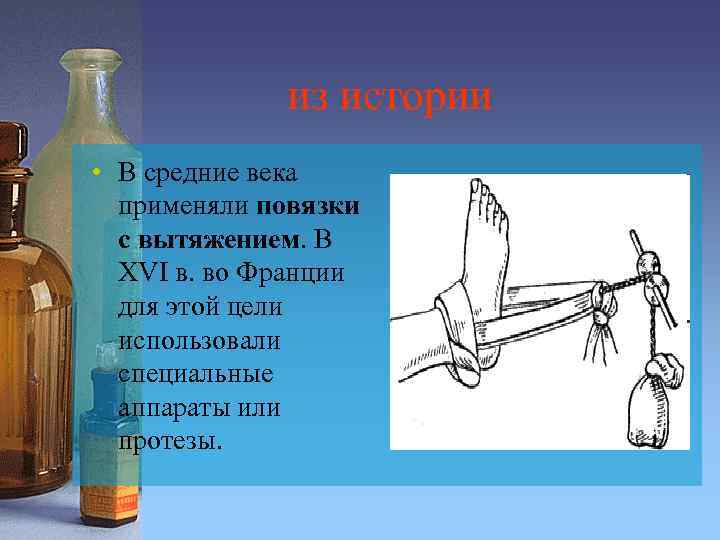 из истории • В средние века применяли повязки с вытяжением. В XVI в. во