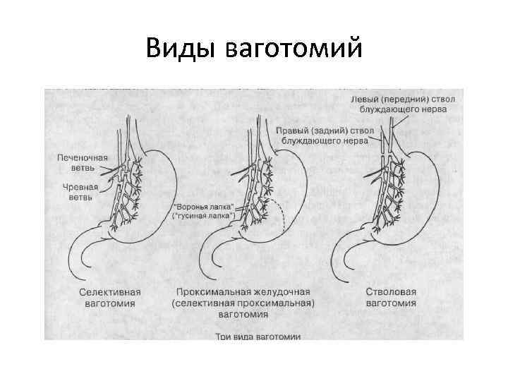 Виды моторной активности желудка