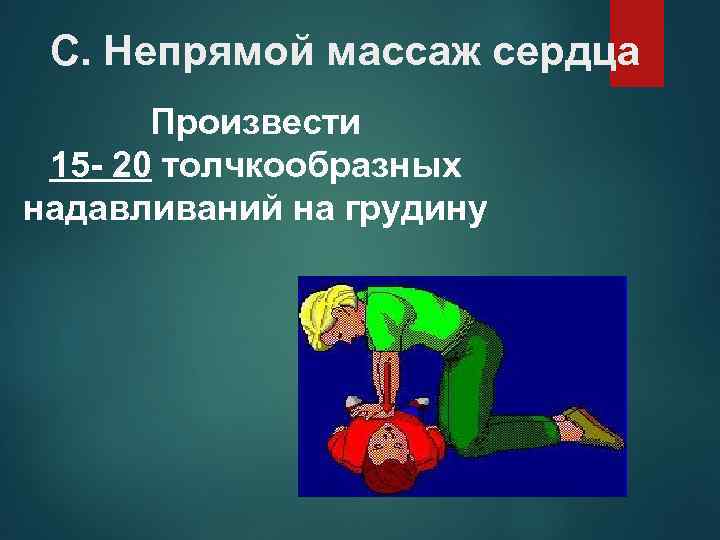 С. Непрямой массаж сердца Произвести 15 - 20 толчкообразных надавливаний на грудину 