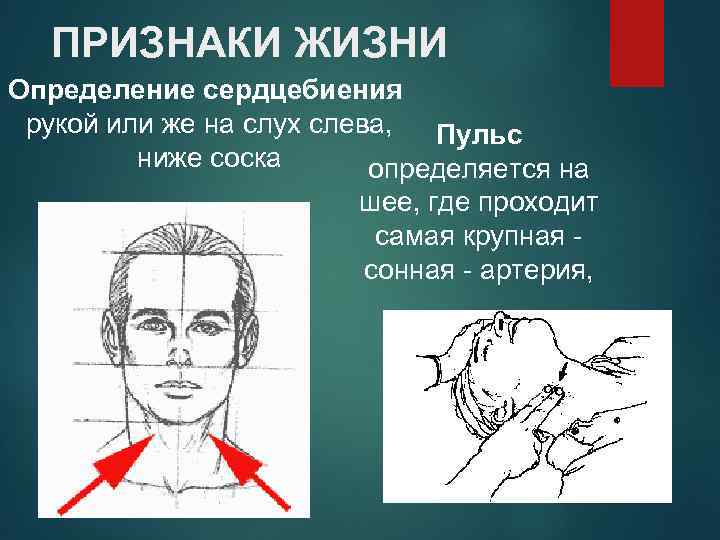 ПРИЗНАКИ ЖИЗНИ Определение сердцебиения рукой или же на слух слева, Пульс ниже соска определяется