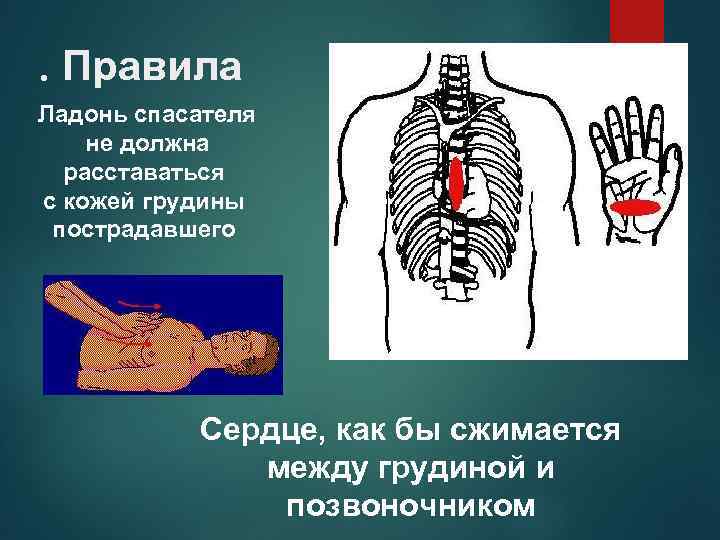 . Правила Ладонь спасателя не должна расставаться с кожей грудины пострадавшего Сердце, как бы