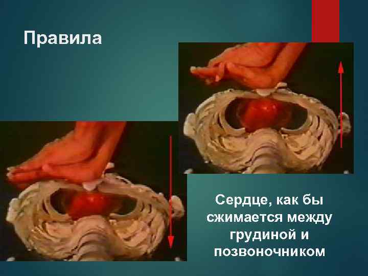Правила Сердце, как бы сжимается между грудиной и позвоночником 