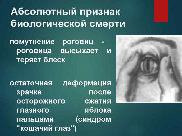 Абсолютный признак биологической смерти помутнение роговица высыхает и теряет блеск остаточная деформация зрачка после