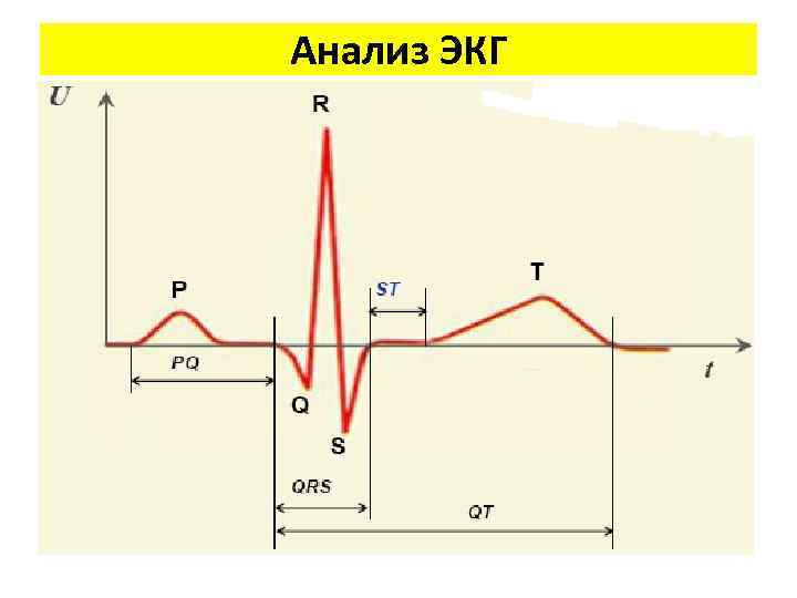 Анализ ЭКГ 