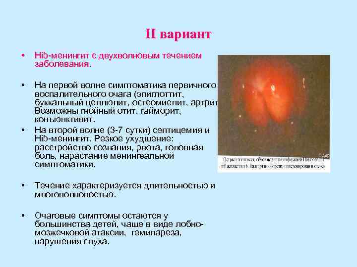 II вариант • Hib-менингит с двухволновым течением II вариант • Hib-менингит с двухволновым течением