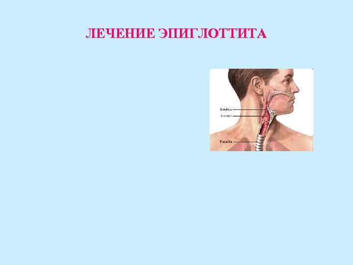 ЛЕЧЕНИЕ ЭПИГЛОТТИТА ЛЕЧЕНИЕ ЭПИГЛОТТИТА