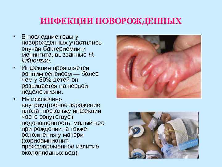 ИНФЕКЦИИ НОВОРОЖДЕННЫХ • В последние годы у новорожденных участились случаи ИНФЕКЦИИ НОВОРОЖДЕННЫХ • В последние годы у новорожденных участились случаи