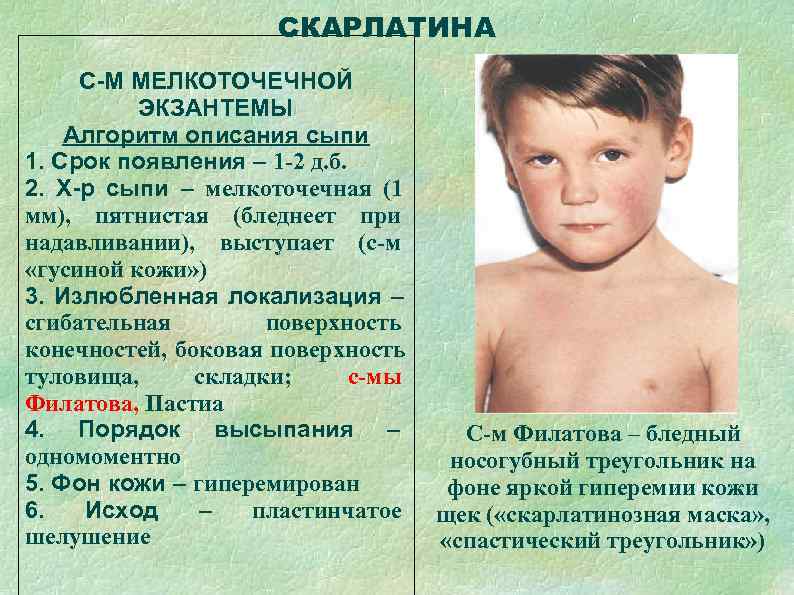      СКАРЛАТИНА С-М МЕЛКОТОЧЕЧНОЙ  ЭКЗАНТЕМЫ Алгоритм описания сыпи 1.