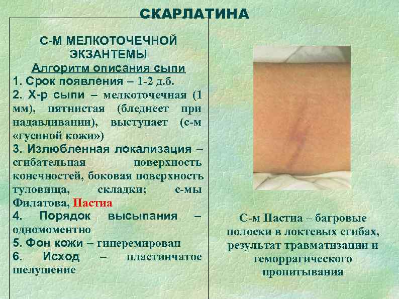      СКАРЛАТИНА С-М МЕЛКОТОЧЕЧНОЙ  ЭКЗАНТЕМЫ Алгоритм описания сыпи 1.