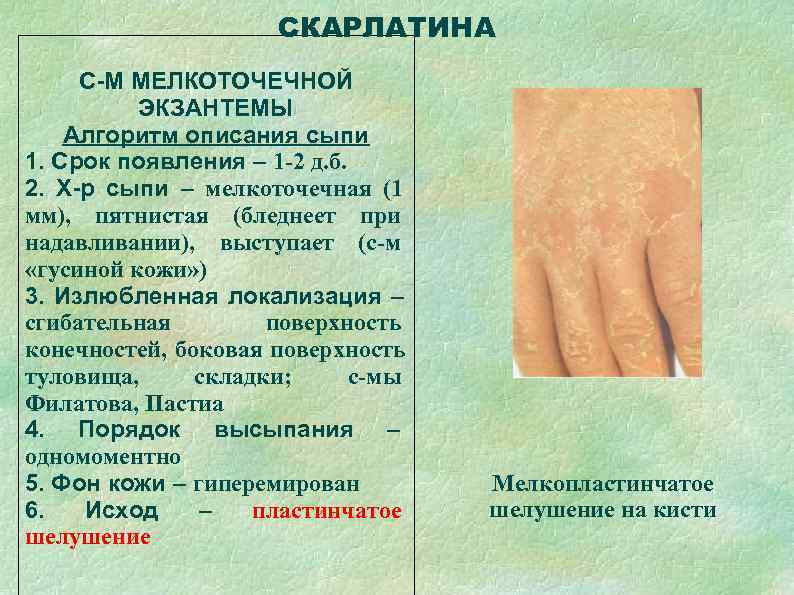      СКАРЛАТИНА С-М МЕЛКОТОЧЕЧНОЙ  ЭКЗАНТЕМЫ Алгоритм описания сыпи 1.