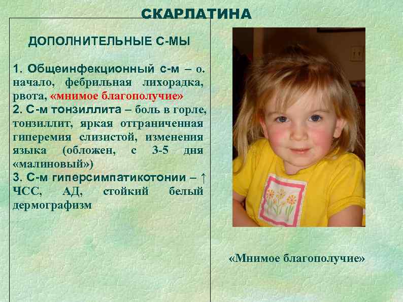      СКАРЛАТИНА  ДОПОЛНИТЕЛЬНЫЕ С-МЫ 1. Общеинфекционный с-м – о.