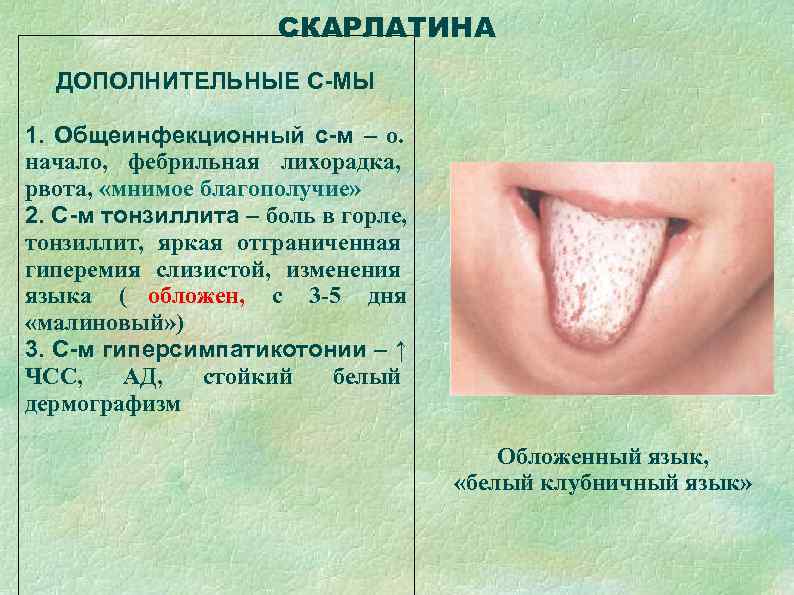      СКАРЛАТИНА  ДОПОЛНИТЕЛЬНЫЕ С-МЫ 1. Общеинфекционный с-м – о.