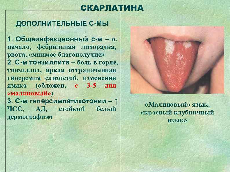      СКАРЛАТИНА  ДОПОЛНИТЕЛЬНЫЕ С-МЫ 1. Общеинфекционный с-м – о.
