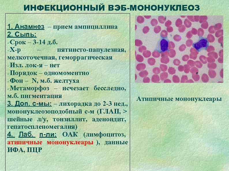  ИНФЕКЦИОННЫЙ ВЭБ-МОНОНУКЛЕОЗ 1. Анамнез – прием ампициллина 2. Сыпь:  Срок – 3