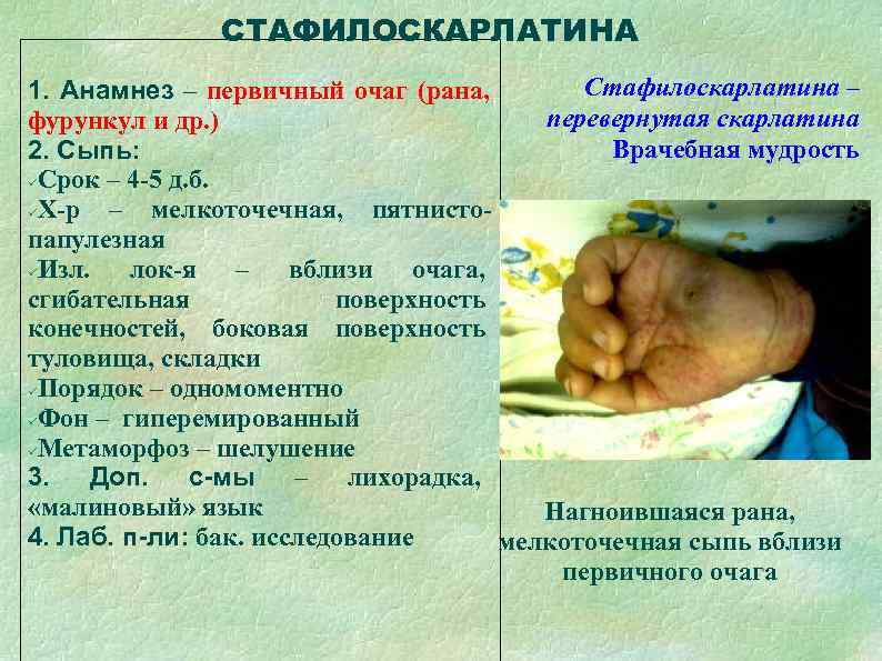    СТАФИЛОСКАРЛАТИНА 1. Анамнез – первичный очаг (рана,   Стафилоскарлатина –
