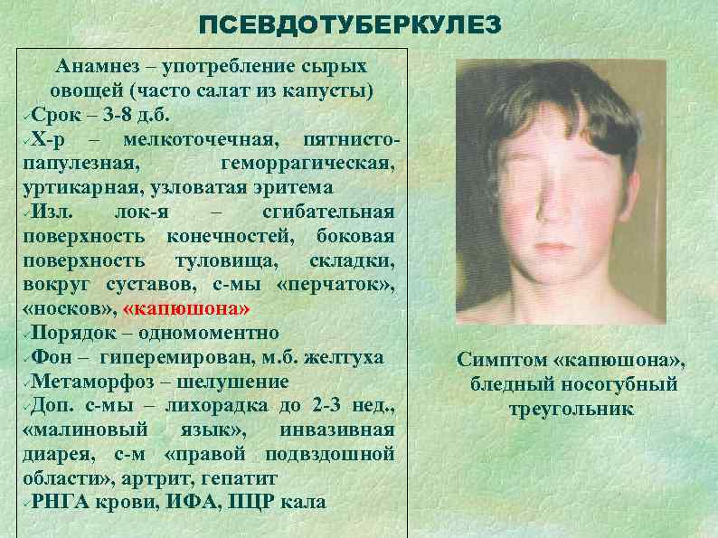    ПСЕВДОТУБЕРКУЛЕЗ Анамнез – употребление сырых  овощей (часто салат из капусты)