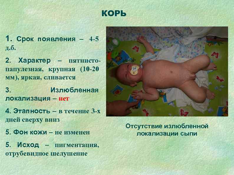       КОРЬ  1. Срок появления – 4 -5