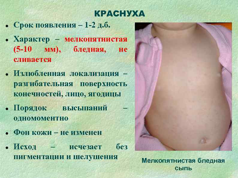     КРАСНУХА Срок появления – 1 -2 д. б. Характер –