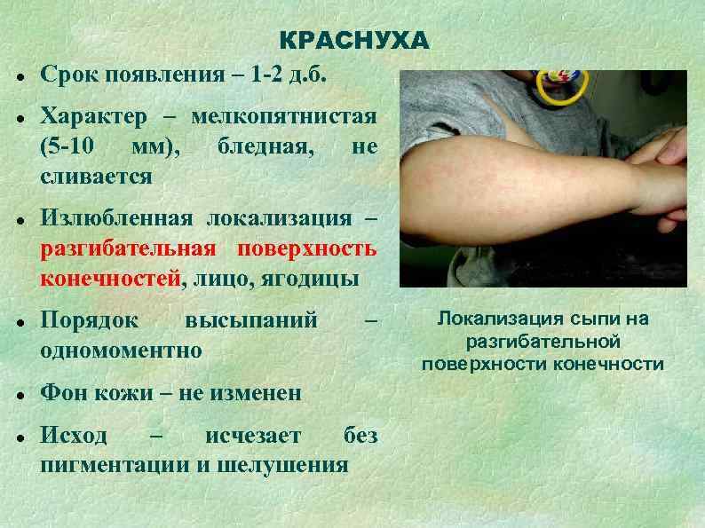     КРАСНУХА Срок появления – 1 -2 д. б. Характер –