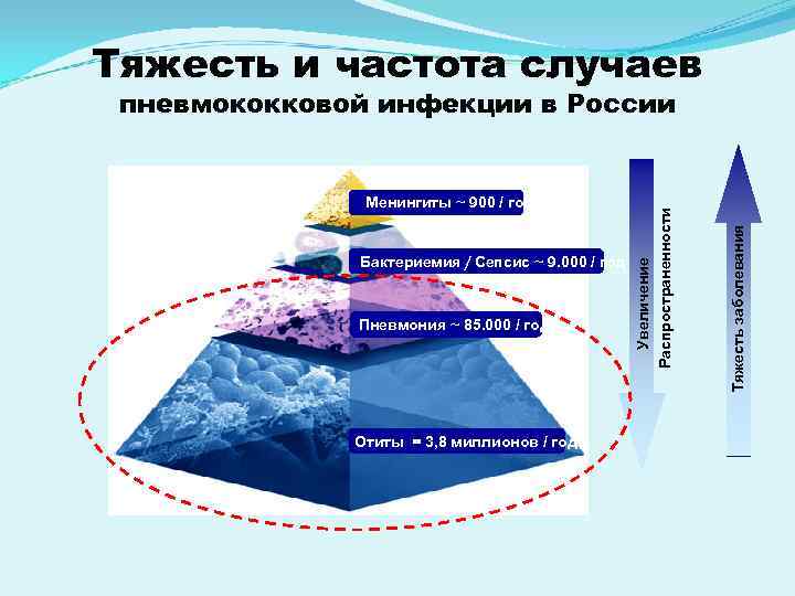 Тяжесть и частота случаев пневмококковой инфекции в России Менингиты ~ 900 / Тяжесть и частота случаев пневмококковой инфекции в России Менингиты ~ 900 /