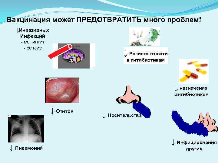 Вакцинация может ПРЕДОТВРАТИТЬ много проблем! ↓Инвазивных Инфекций - менингит - сепсис Вакцинация может ПРЕДОТВРАТИТЬ много проблем! ↓Инвазивных Инфекций - менингит - сепсис
