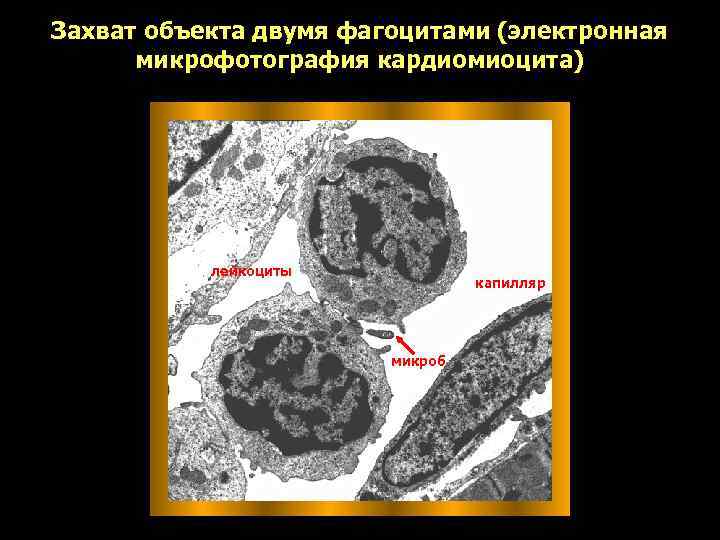 Захват объекта двумя фагоцитами (электронная  микрофотография кардиомиоцита)    лейкоциты  