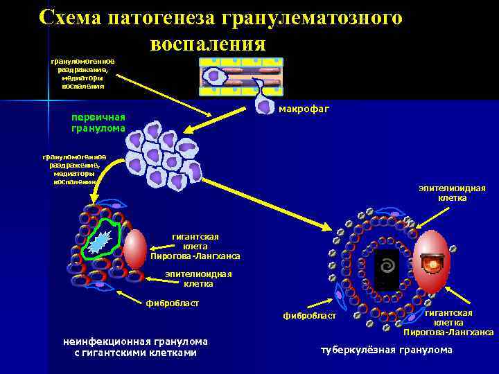 Патогенез воспаления схема