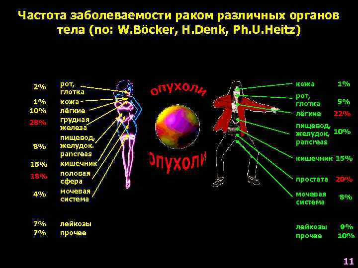 Частота заболеваемости раком различных органов  тела (по: W. Böcker, H. Denk, Ph. U.