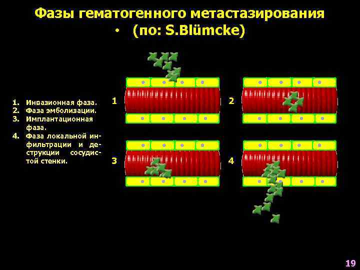  Фазы гематогенного метастазирования    • (по: S. Blümcke)  1. Инвазионная