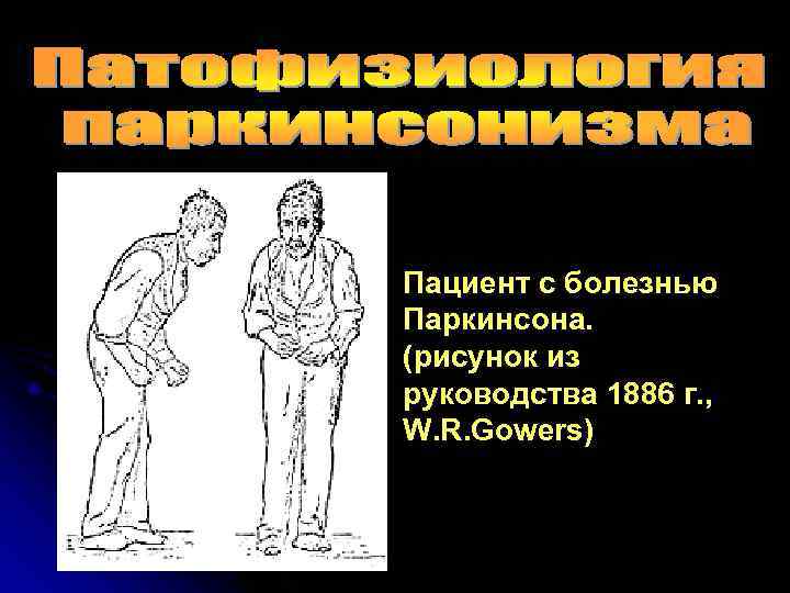 Пациент с болезнью Паркинсона. (рисунок из руководства 1886 г. , W. R. Gowers) 