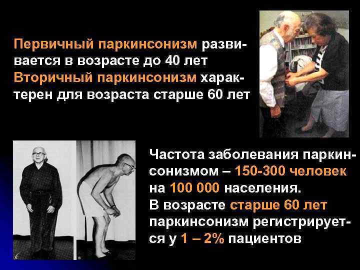 Первичный паркинсонизм разви- вается в возрасте до 40 лет Вторичный паркинсонизм харак- терен для
