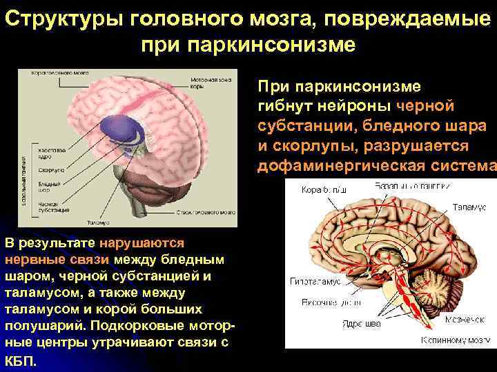 Неспецифические изменения головного мозга