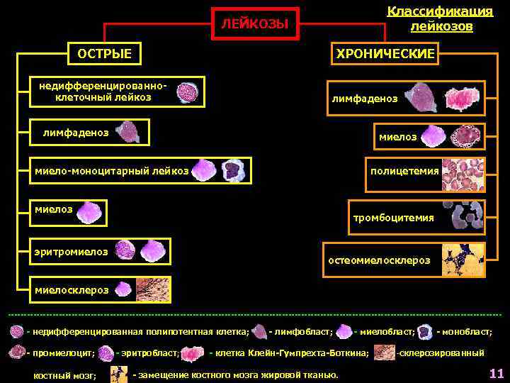        Классификация    ЛЕЙКОЗЫ  
