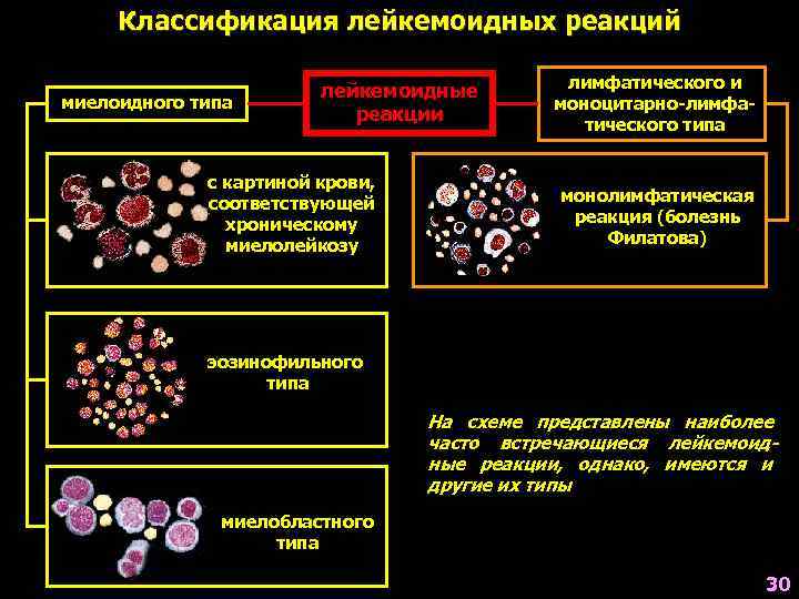 Лейкозы лейкемоидные реакции