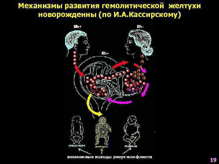 Схема гемолитической желтухи