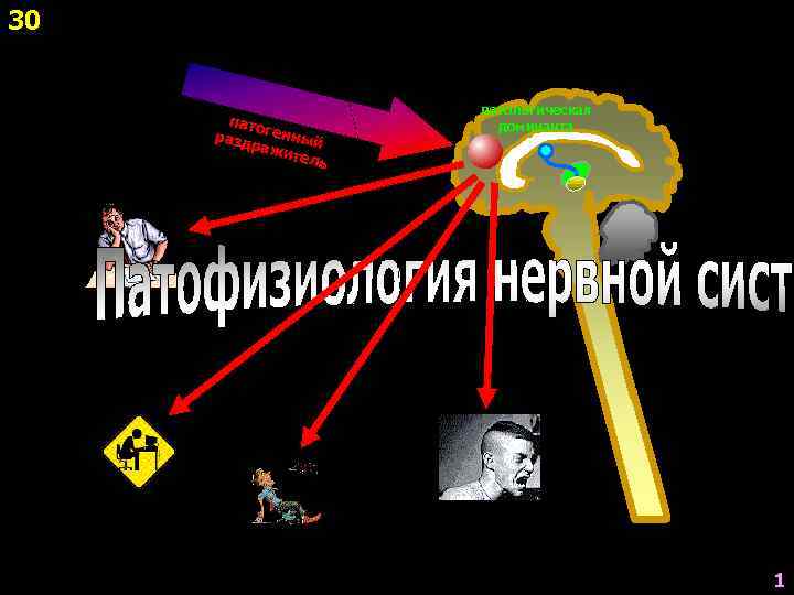 30     патологическая  пато   доминанта разд генный 