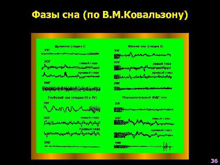 Фазы сна (по В. М. Ковальзону)      36 