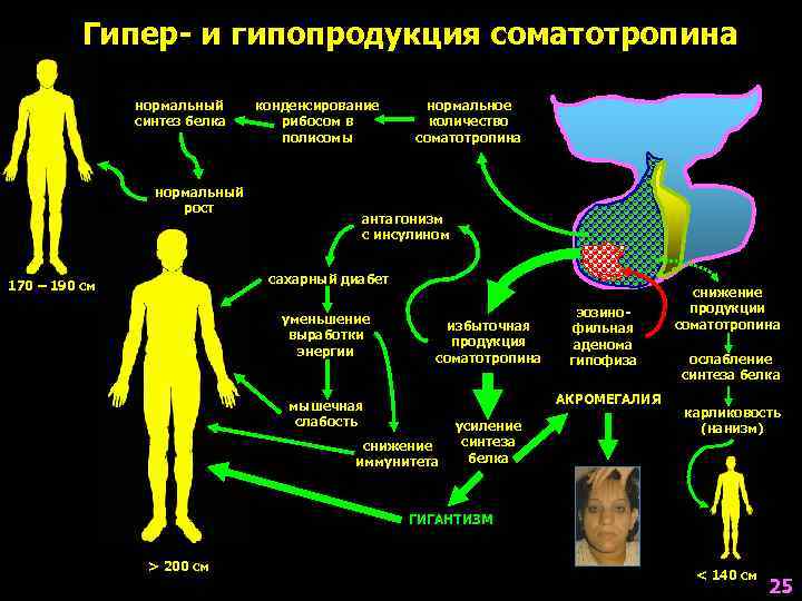    Гипер- и гипопродукция соматотропина   нормальный конденсирование нормальное  