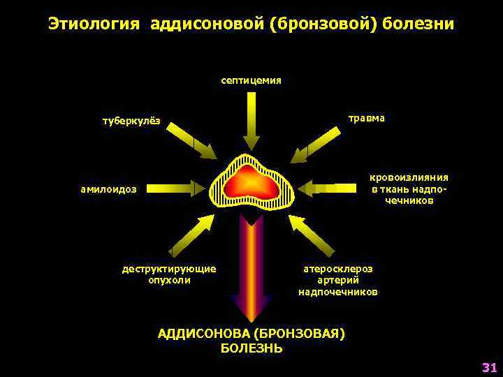 Этиология аддисоновой (бронзовой) болезни     септицемия   туберкулёз  