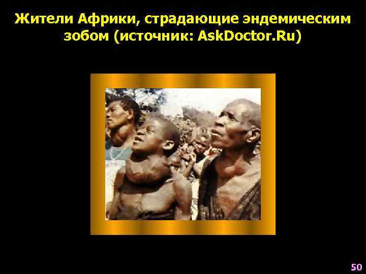 Жители Африки, страдающие эндемическим  зобом (источник: Ask. Doctor. Ru)    50