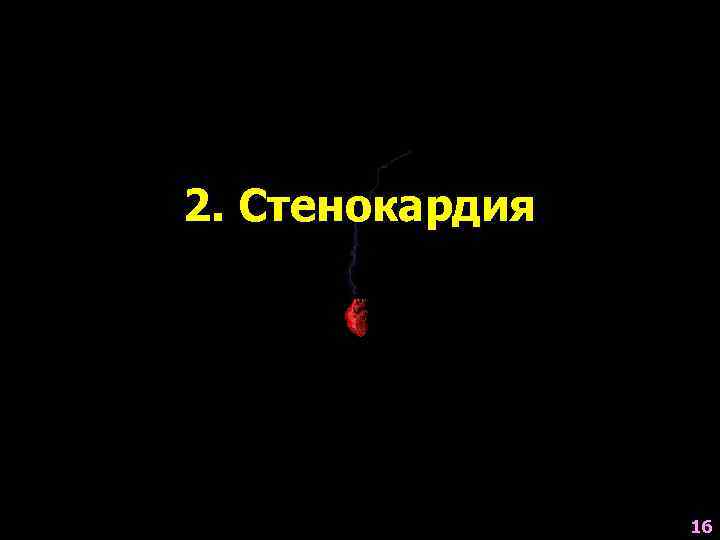 2. Стенокардия     16 