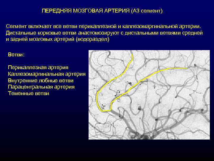   ПЕРЕДНЯЯ МОЗГОВАЯ АРТЕРИЯ (А 3 сегмент) Сегмент включает все ветви перикаллезной и