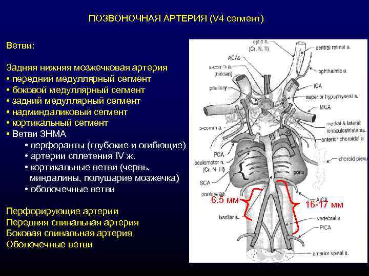    ПОЗВОНОЧНАЯ АРТЕРИЯ (V 4 сегмент) Ветви:  Задняя нижняя мозжечковая артерия