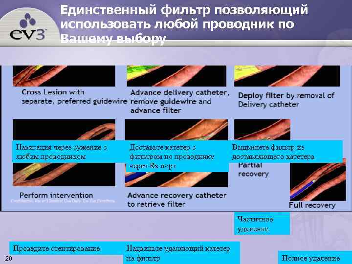    Единственный фильтр позволяющий   использовать любой проводник по  